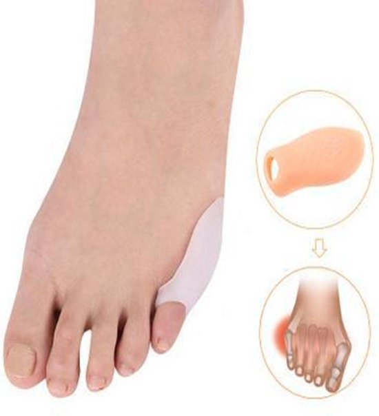 Bunionette - Kleine teen beschermer van Merkloos