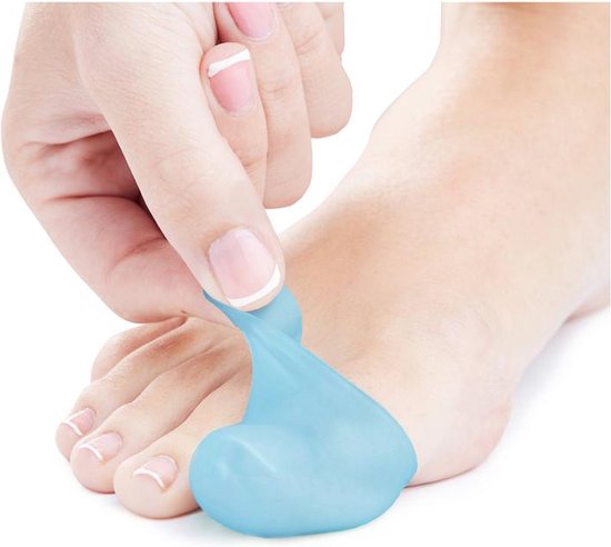 NatraCure gel teenkap blauw (6 stuks) - brandende tenen - druk en wrijving tussen de tenen - smartgel - hydrateert en verzacht de huid - wasbaar